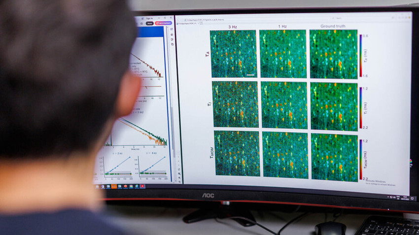 Quantensprung in der Zellbildgebung dank Ostschweizer Technologie